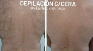 DEPILACION C/CERA ELASTICADA O ROLL ON (espalda completa- Hombre)