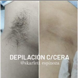 DEPILACION C/CERA (axilas)