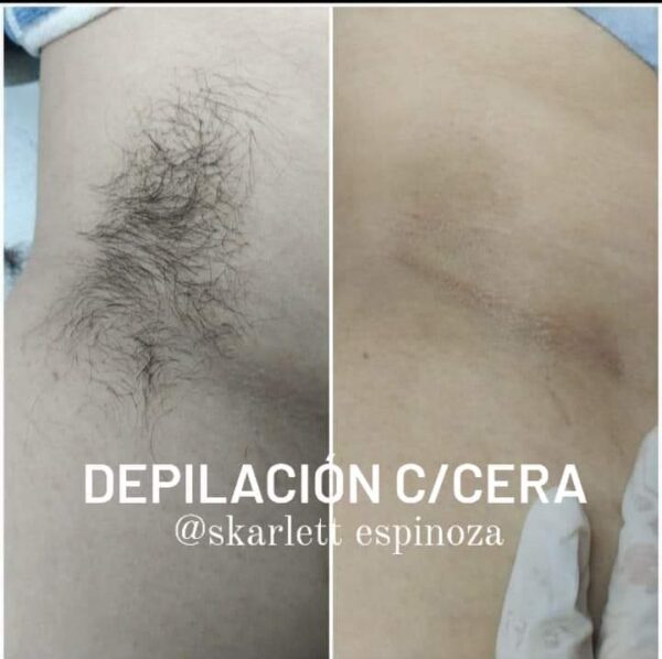 DEPILACION C/CERA (axilas)