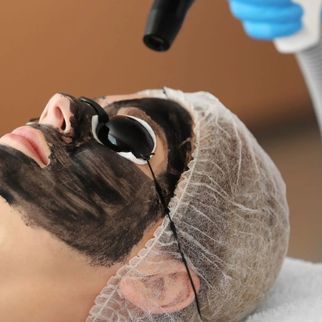 PEELING HOLLYWOOD (4 SESIONES)