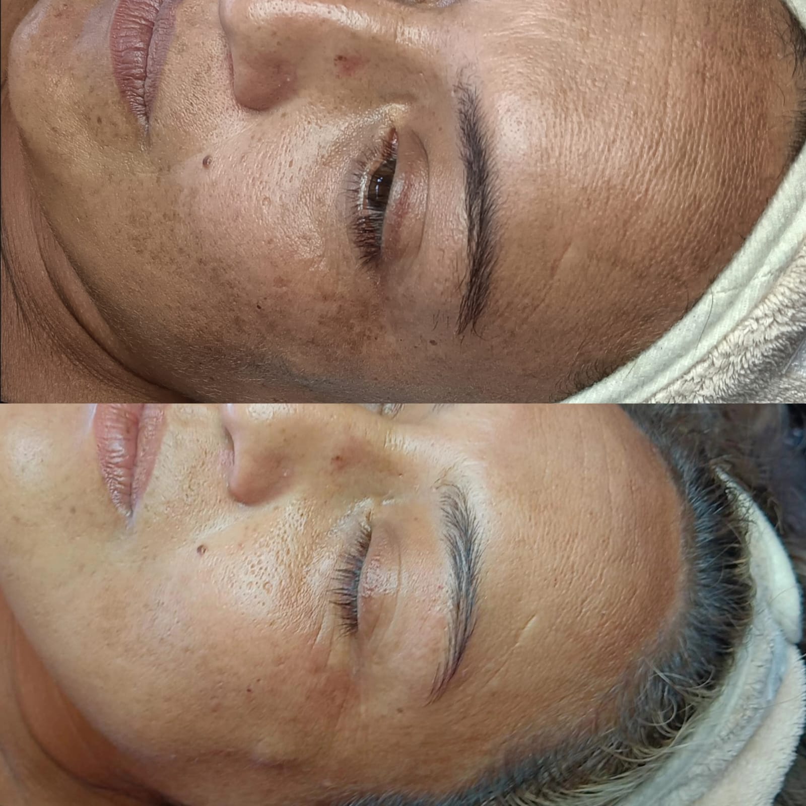 PEELING HOLLYWOOD (4 SESIONES) - Imagen 3