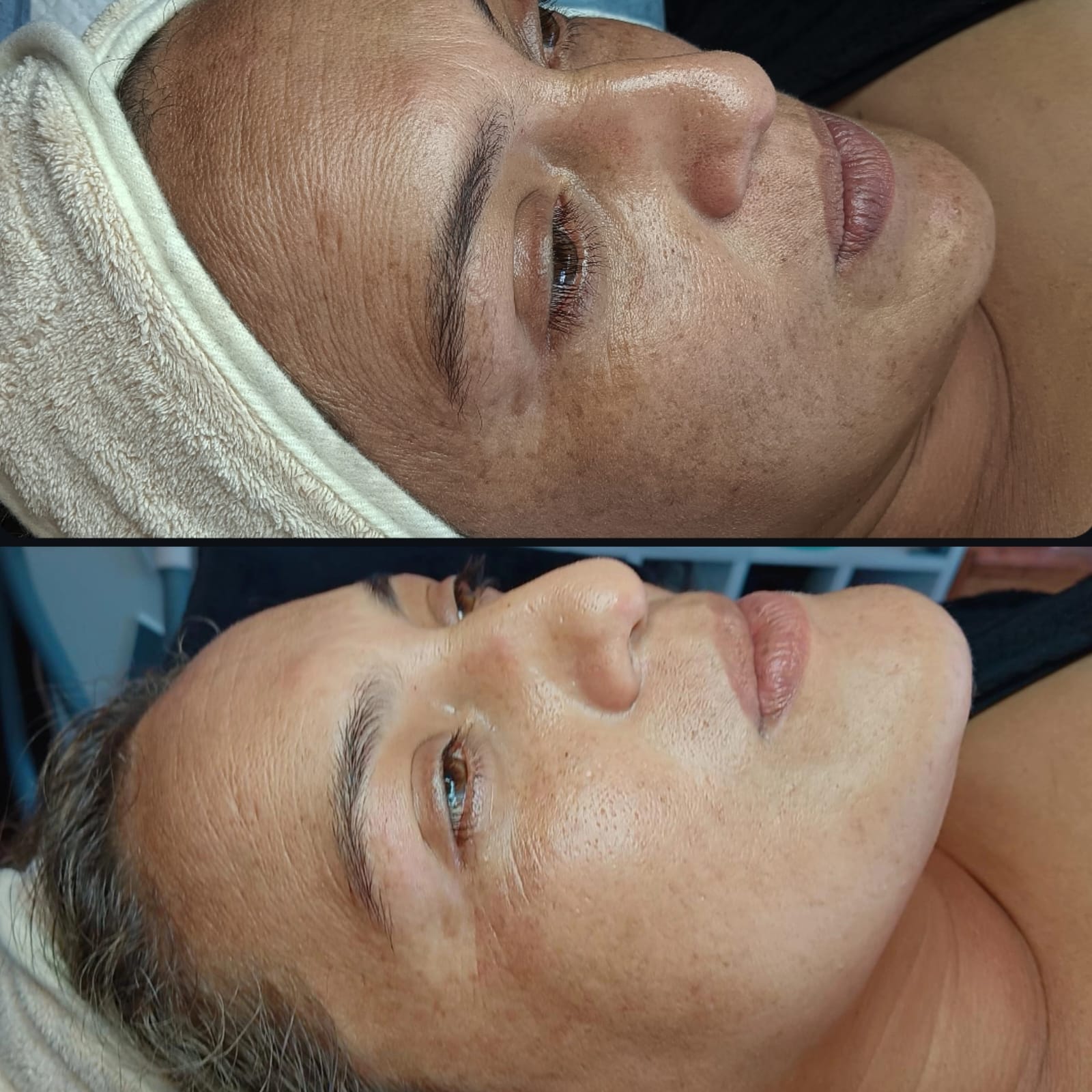 PEELING HOLLYWOOD (4 SESIONES) - Imagen 4