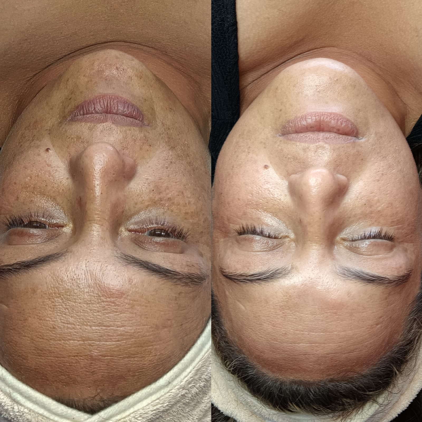 PEELING HOLLYWOOD (4 SESIONES) - Imagen 2