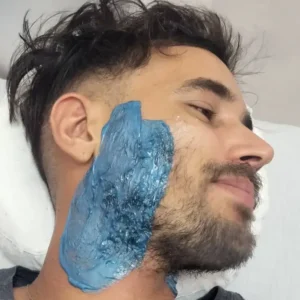 Depilacion barba