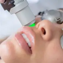 DEPILACION LASER (BOZO PATILLA MENTON ) INCLUYE SOLO 1 A ELECCION 6 SESIONES