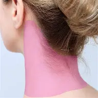 DEPILACION LASER CUELLO POSTERIOR ) 6 SESIONES