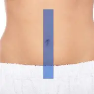 DEPILACION LASER (LINEA ALBA) 6 SESIONES